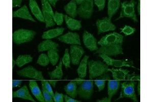Immunofluorescence analysis of L929 cells using NDUFB4 Polyclonal Antibody at dilution of 1:100 (40x lens). (NDUFB4 抗体)