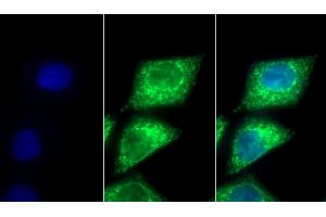 Detection of PDHA1 in Human HepG2 cell using Polyclonal Antibody to Pyruvate dehydrogenase alpha 1 (PDHA1) (PDHA1 抗体  (AA 30-390))