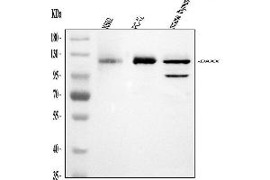 Western blot analysis of Daxx using anti-Daxx antibody (ABIN3043822). (DAXX 抗体  (AA 56-345))