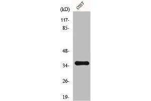 Western Blot analysis of 293 cells using Fos B Polyclonal Antibody (FOSB 抗体)