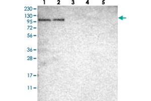 Western blot analysis of Lane 1: RT-4, Lane 2: U-251 MG, Lane 3: Human Plasma, Lane 4: Liver, Lane 5: Tonsil with SGEF polyclonal antibody . (SGEF 抗体)