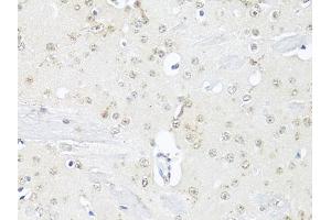 Immunohistochemistry of paraffin-embedded mouse brain using RBFOX3 antibody (ABIN1874561) at dilution of 1:100 (40x lens). (NeuN 抗体)