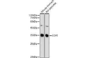 Western blot analysis of extracts of various cell lines, using COPE antibody (ABIN6133492, ABIN6138873, ABIN6138874 and ABIN6214159) at 1:1000 dilution. (COPE 抗体  (AA 1-308))