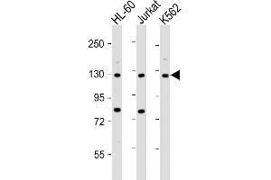 All lanes : Anti-ATP2A3 Antibody (N-Term) at 1:2000 dilution Lane 1: HL-60 whole cell lysate Lane 2: Jurkat whole cell lysate Lane 3: K562 whole cell lysate Lysates/proteins at 20 μg per lane. (ATP2A3 抗体  (AA 13-47))