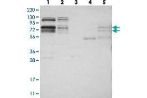 Western blot analysis of Lane 1: RT-4, Lane 2: U-251 MG, Lane 3: Human Plasma, Lane 4: Liver, Lane 5: Tonsil with RBM28 polyclonal antibody  at 1:250-1:500 dilution. (RBM28 抗体)