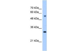 TTC5 antibody used at 0. (TTC5 抗体  (C-Term))