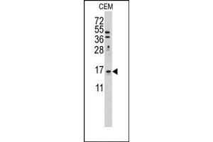 Image no. 1 for anti-LSM1 Homolog, U6 Small Nuclear RNA Associated (LSM1) (C-Term) antibody (ABIN358046)