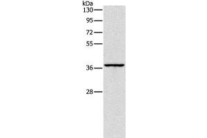 Western Blot analysis of Huvec cell using APOL2 Polyclonal Antibody at dilution of 1:375 (Apolipoprotein L 2 抗体)