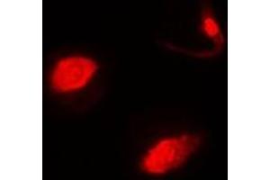 Immunofluorescent analysis of SUFU staining in MCF7 cells. (SUFUH 抗体)