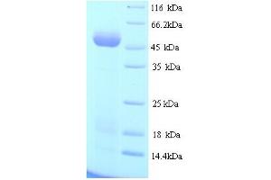 SDS-PAGE (SDS) image for Tu Translation Elongation Factor, Mitochondrial (Tufm) (AA 1-396), (full length) protein (His tag) (ABIN5713920) (TUFM Protein (AA 1-396, full length) (His tag))