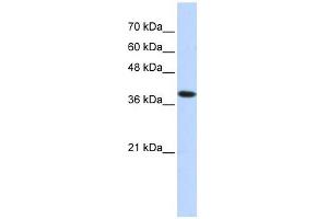 ATP4B antibody used at 1 ug/ml to detect target protein. (ATP4b 抗体  (Middle Region))