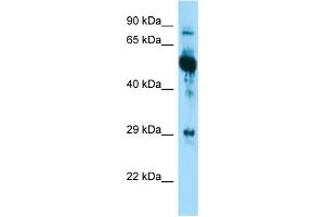 WB Suggested Anti-KRT6A Antibody Titration: 1. (KRT6A 抗体  (Middle Region))