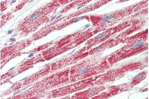 Immunohistochemistry (IHC) image for anti-ATP Synthase, H+ Transporting, Mitochondrial Fo Complex, Subunit B1 (ATP5F1) (AA 142-153) antibody (ABIN2613392)