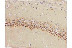 Anti-5HT1A Receptor antibody, IHC(P): Rat Brain Tissue (Serotonin Receptor 1A 抗体  (C-Term))