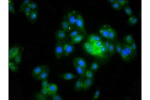Immunofluorescence staining of HepG2 cells with ABIN7143778 at 1:200, counter-stained with DAPI. (MGAT5 抗体  (AA 107-217))