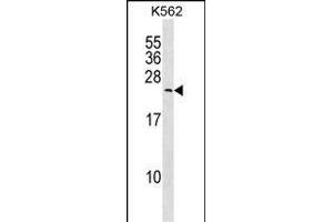MYL6B Antibody (Center) (ABIN1538709 and ABIN2850105) western blot analysis in K562 cell line lysates (35 μg/lane). (MYL6B 抗体  (AA 96-123))