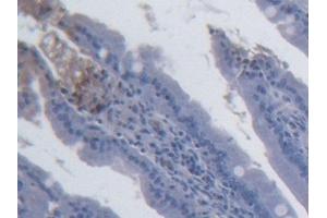 Detection of IL15 in Rat Small intestine Tissue using Monoclonal Antibody to Interleukin 15 (IL15) (IL-15 抗体  (AA 49-162))