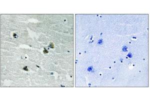 Immunohistochemistry analysis of paraffin-embedded human brain tissue using MER/SKY (Phospho-Tyr749/681) antibody. (MER/SKY (pTyr681), (pTyr749) 抗体)