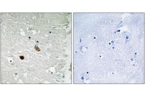 Immunohistochemistry analysis of paraffin-embedded human brain tissue, using CaMK2-beta/gamma/delta (Ab-287) Antibody. (CaMK2 beta/gamma/delta (AA 253-302) 抗体)