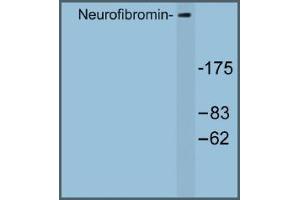 Image no. 1 for anti-Neurofibromin 1 (NF1) antibody (ABIN317682) (Neurofibromin 1 抗体)