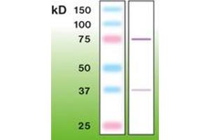 Image no. 1 for anti-Protein Kinase C, beta (PRKCB) antibody (ABIN6756685) (PKC beta 抗体)