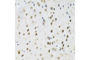 Immunohistochemistry (Paraffin-embedded Sections) (IHC (p)) image for anti-Protein Phosphatase 1, Catalytic Subunit, alpha Isoform (PPP1CA) (AA 1-330) antibody (ABIN6146053)