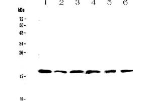 Western blot analysis of IL10 using anti-IL10 antibody . (IL-10 抗体  (AA 19-178))