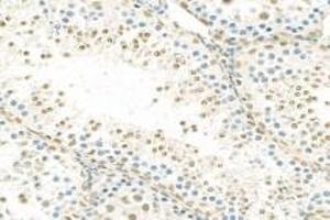 Immunohistochemistry analysis of paraffin-embedded rat testis using,RPAP2 (ABIN7075481) at dilution of 1: 1000