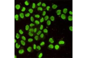Immunofluorescent analysis of Hela cells using Ku80 mouse mAb (1:400). (XRCC5 抗体)