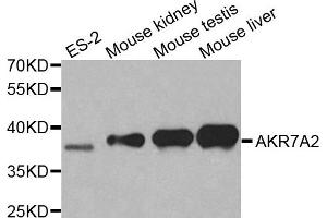 Western blot analysis of extracts of various cell lines, using AKR7A2 antibody. (AKR7A2 抗体  (AA 100-359))