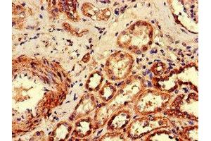 Immunohistochemistry of paraffin-embedded human kidney tissue using ABIN7174788 at dilution of 1:100 (C1ORF189 抗体  (AA 1-101))