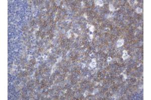 Image no. 1 for anti-Mucin 16, Cell Surface Associated (CA125) (AA 10329-10628) antibody (ABIN1490811) (MUC16 抗体  (AA 10329-10628))