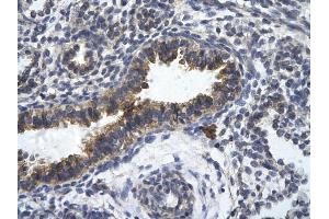Rabbit Anti-ZFR Antibody       Paraffin Embedded Tissue:  Human bronchiole epithelium   Cellular Data:  Epithelial cells of renal tubule  Antibody Concentration:   4. (ZFR 抗体  (Middle Region))