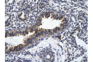 Rabbit Anti-ZFR Antibody       Paraffin Embedded Tissue:  Human bronchiole epithelium   Cellular Data:  Epithelial cells of renal tubule  Antibody Concentration:   4.