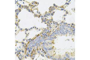 Immunohistochemistry of paraffin-embedded rat lung using UBE2B Antibody (ABIN5973734) at dilution of 1/100 (40x lens). (UBE2B 抗体)