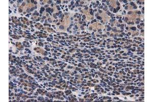 Image no. 16 for anti-Destrin (Actin Depolymerizing Factor) (DSTN) antibody (ABIN1497910) (Destrin 抗体)