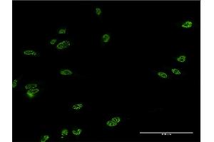 Immunofluorescence of monoclonal antibody to LHX4 on HeLa cell. (LHX4 抗体  (AA 291-390))