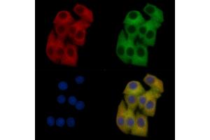 AQP2 Mouse Monoclonal Antibody staining Hela cells by IF/ICC. (AQP2 抗体)
