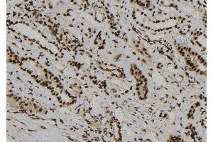 ABIN6273186 at 1/100 staining Human kidney tissue by IHC-P. (WDR46 抗体  (Internal Region))