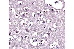 LPL antibody immunohistochemistry analysis in formalin fixed and paraffin embedded human brain tissue. (Lipoprotein Lipase 抗体  (AA 300-327))