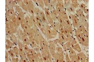 Immunohistochemistry of paraffin-embedded human heart tissue using ABIN7150025 at dilution of 1:100 (DDR2 抗体  (AA 447-540))