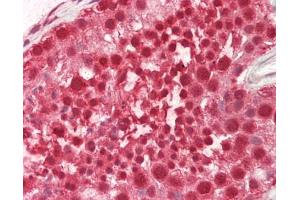 Immunohistochemistry (Paraffin-embedded Sections) (IHC (p)) image for anti-Cleavage Stimulation Factor, 3' Pre-RNA, Subunit 2, 64kDa (CSTF2) (N-Term) antibody (ABIN6756545)