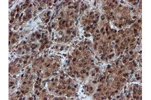 Image no. 2 for anti-Proteasome Subunit alpha 6 (PSMA6) antibody (ABIN1500464) (PSMA6 抗体)