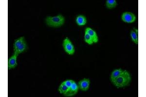Immunofluorescence staining of HepG2 cells with ABIN7156745 at 1:100, counter-stained with DAPI. (IL1R1 抗体  (AA 18-320))