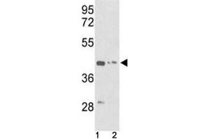Western blot analysis of g-Actin antibody and (1) K562 and (2) HepG2 lysate (Actin, gamma 1 抗体  (AA 188-215))