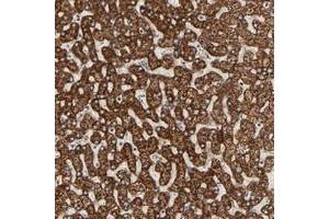 Immunohistochemical staining of human liver with ARSD polyclonal antibody  shows strong cytoplasmic positivity with a granular pattern in hepatocytes. (Arylsulfatase D 抗体)