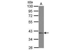 Image no. 2 for anti-Decapping Enzyme, Scavenger (DCPS) (AA 1-149) antibody (ABIN1497779) (DCPS 抗体  (AA 1-149))