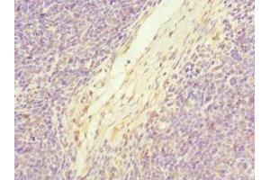Immunohistochemistry of paraffin-embedded human thymus tissue using ABIN7174771 at dilution of 1:100 (C19orf48 抗体  (AA 1-117))