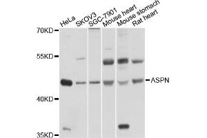 Western blot analysis of extracts of various cell lines, using ASPN antibody (ABIN4902960) at 1:1000 dilution. (Asporin 抗体)