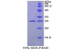 SDS-PAGE analysis of Rat GSTk1 Protein. (GSTK1 蛋白)